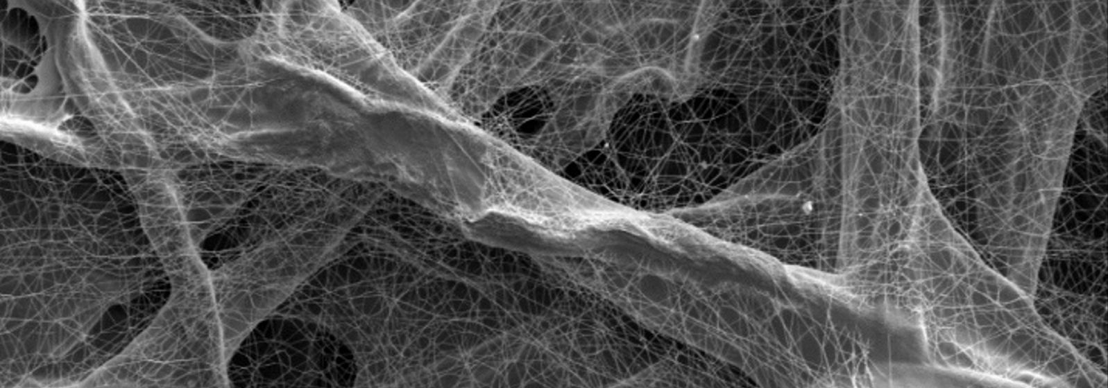 Es hat ein bisschen was von einem dreidimensionalen Spinnenweben-Gewirr: Aufnahme vom Inneren eines nanofaserbeschichteten Filtermediums.